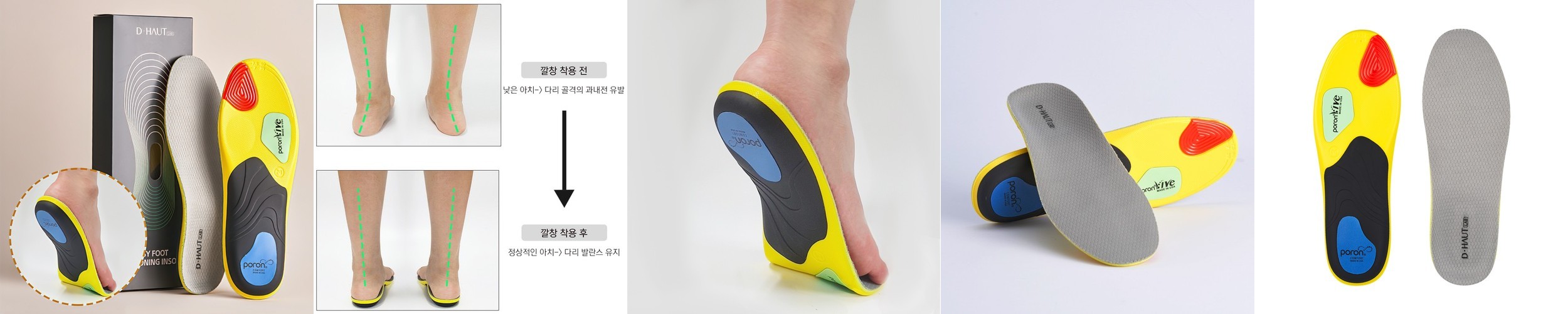 바디인라이프 족저근막염 깔창 스프링 충격흡수 기능성 아치 안전화 운동화 신발 인솔