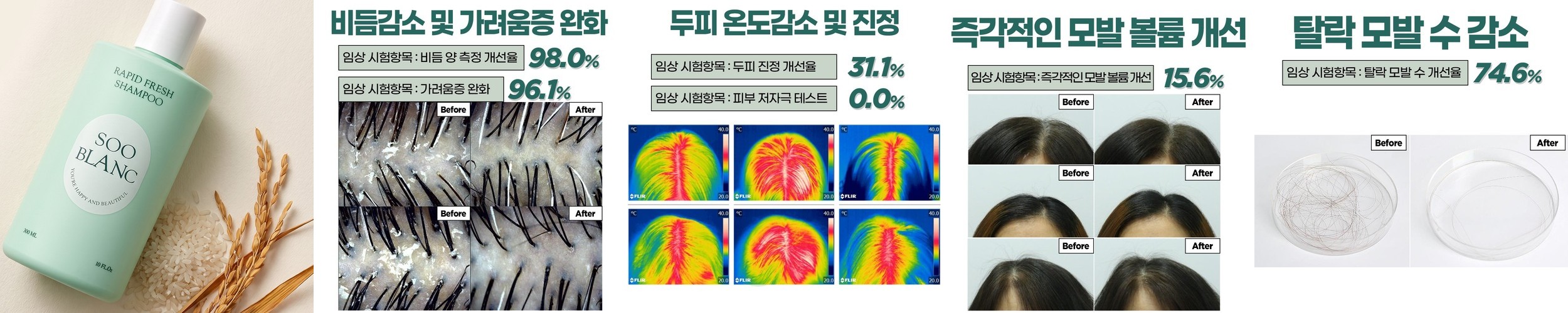 동의생모 탈모샴푸 탈모케어 두피케어 150일 프로그램